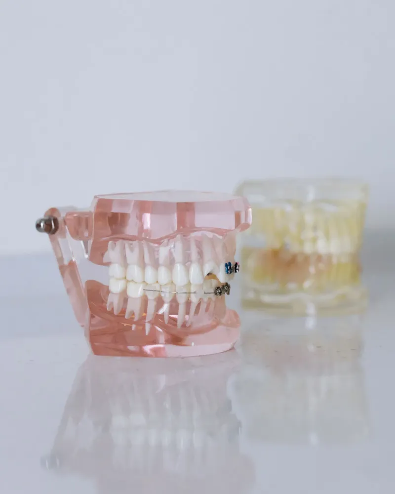 Dental Crowns & Bridges at Radiant Dentistry ATX in Pflugerville, TX