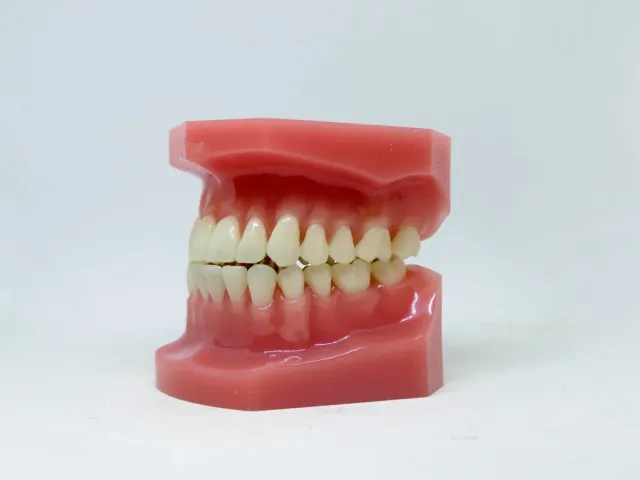 Full denture model with natural-looking teeth and gums