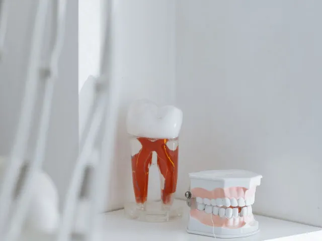 Tooth model showing the nerve inside a tooth, the source of most dental pain