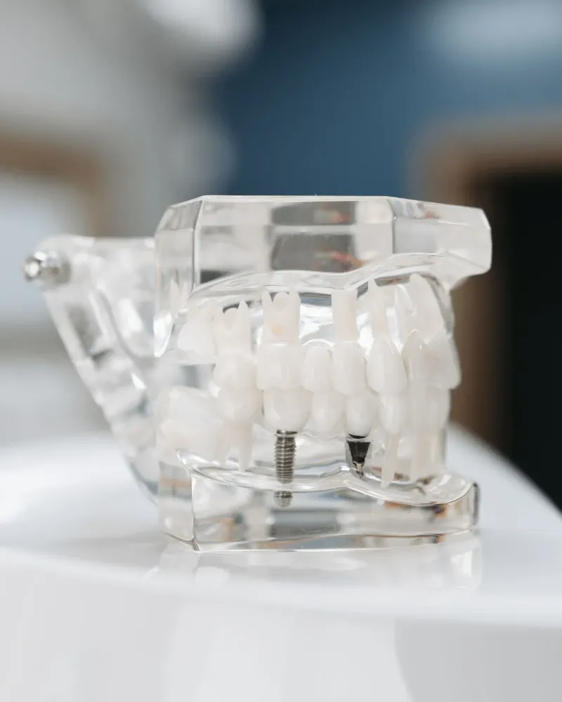 Root Canal Treatment at Radiant Dentistry ATX in Pflugerville, TX