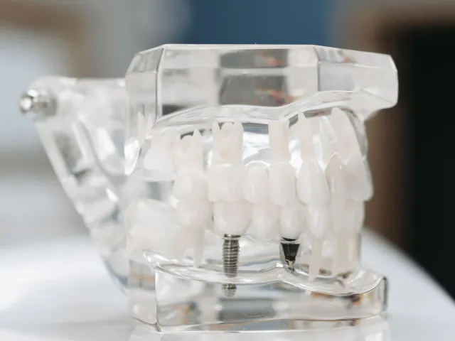 Transparent jaw model showing tooth roots