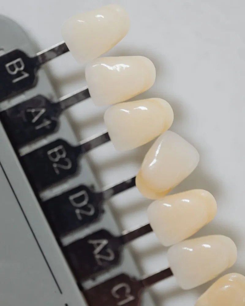 Teeth Whitening at Radiant Dentistry ATX in Pflugerville, TX