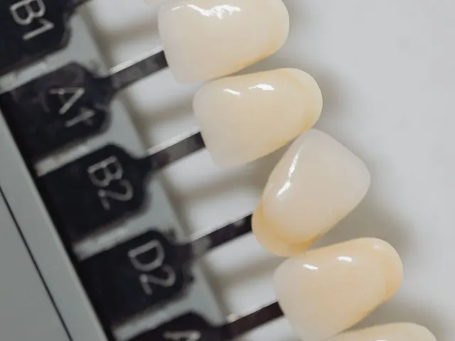 Tooth shade guide used to measure teeth whitening results
